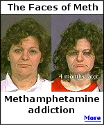Those addicted to meth can no longer look in the mirror.